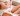 ayurvedic enema therapy and basti benefits