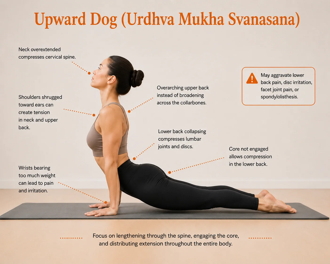 Illustration of Upward-Facing Dog (Urdhva Mukha Svanasana) used in this guide to yoga and back pain. While this popular yoga pose can improve spinal mobility and posture, some practitioners compensate by collapsing into the lower back instead of distributing spinal extension evenly throughout the body. For people with disc issues, facet joint irritation, spinal stenosis, or chronic lower back pain, this pattern may increase discomfort. The image highlights common alignment mistakes and safer movement principles for protecting the lumbar spine.